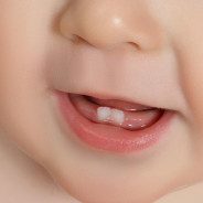 BABY’S FIRST TRIP TO THE DENTIST