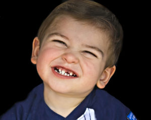 DR. DENNIS DUNNE, LITTLE BOY SMIILING, MISSING TEETH