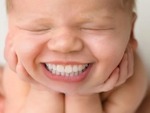 BABIES BORN WITH TEETH?